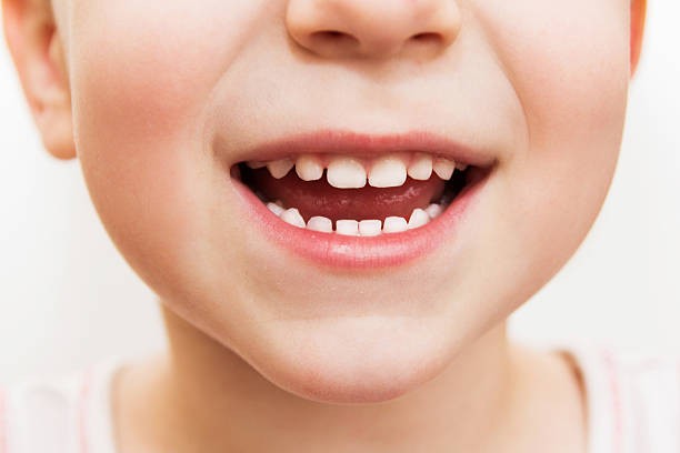 Poruchy vývoja tvrdých zubných tkanív (DMH a MIH)