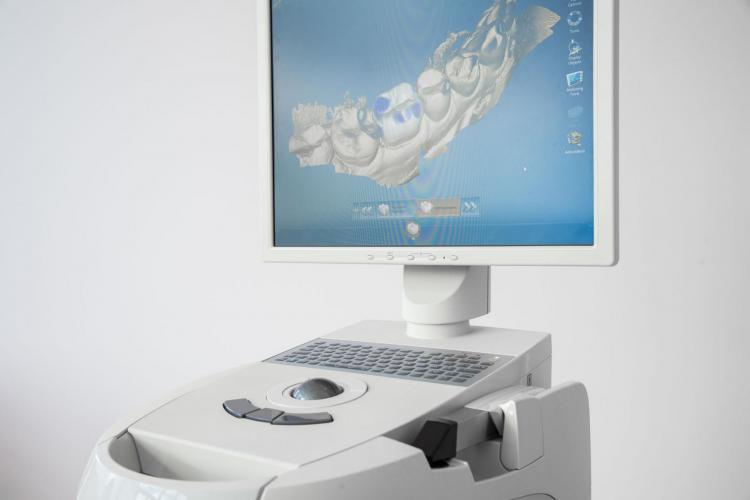 CEREC CAD-CAM technology